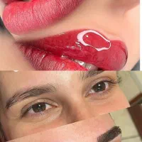 مدل شیدینگ لب و میکرو وفیبروز هزینه موادگرفته میشه