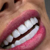 کامپوزیت نانوسرامیکی فکی چهارده