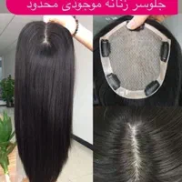 فروش و ترمیم پروتز مو طبیعی