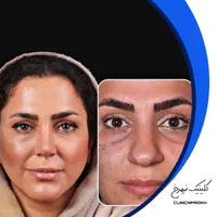 عمل بینی کمتر از ۲۵ میلیون|خدمات آرایشگری و زیبایی|تهران, نظامی گنجوی (توانیر)|دیوار