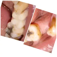 لابراتوار لبخند زیبا مبلغ ۱۵ میلیون و چک صیادی|خدمات آرایشگری و زیبایی|آباده, |دیوار