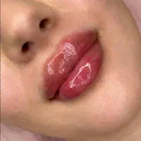 مدل تزریق ژل و بوتاکس و آموزش در کلینیک زیبایی|خدمات آرایشگری و زیبایی|کرج, چهارصد دستگاه|دیوار