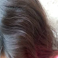 محلول شپش