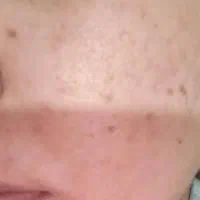 راهنمایی برای اموزش دوره پوست سا اسکین کر