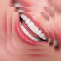 تخفیف 50 درصدی کامپوزیت و دندان پزشکی