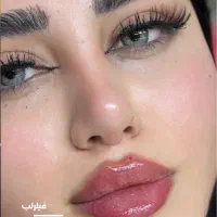 ژل و بوتاکس/پی ار پی/جوانسازی/اندولیفت/مادلینگ