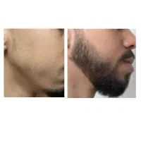 رویشی نوین با روشی نوین