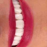 مژده به اهالی محترم گلباف در مورد دندانپزشکی|خدمات آرایشگری و زیبایی|گلباف, |دیوار