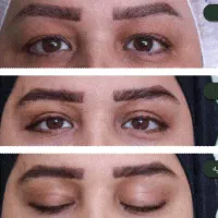 جشنواره پاییزه بلفاروپلاستی|خدمات آرایشگری و زیبایی|تهران, پاسداران|دیوار