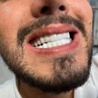 کلینیک تخصصی کامپوزیت هانا|خدمات زیبایی و سلامت|تهران, دهم فروردین|دیوار