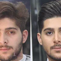 اصلاح دامادی ،پاکسازی پوست و اصلاح درمنزل|خدمات آرایشگری و زیبایی|قدس, شهر‌قدس|دیوار