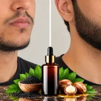 بازگشت پرپشتی ریش