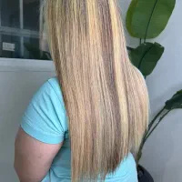 تخفیف ویژه بوتاکس تراپی