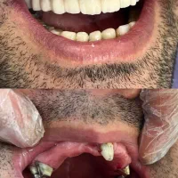 دندانپزشکی با پرداخت یک سوم هزینه|خدمات آرایشگری و زیبایی|سقز, |دیوار