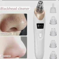 دستگاه میکرودرم خانگی بمب تخفیف ویژه ی یلدا