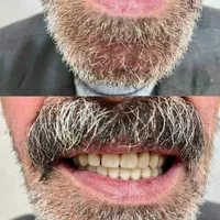 دندانسازی محلات