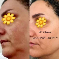 نماینده فروش محصولات پوست موزیبایی LEDORA|آرایشی، بهداشتی، درمانی|هشترود, |دیوار