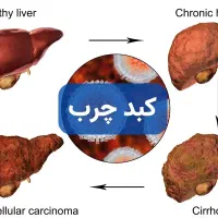 بهبود مشکلات کبدی|آرایشی، بهداشتی، درمانی|گنبد کاووس, |دیوار