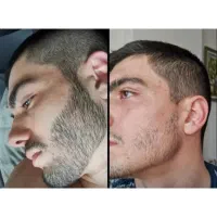 ریش سبیل مو