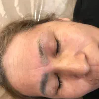 پاک کردن تتو پلینگ کربن لاغری موضعی لیزر مو