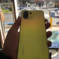 Mi 11 Lite 5g