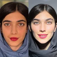 تزریق ژل لب،گونه،زاویه فک ،چانه،بوتاکس و فیلر بدن|خدمات آرایشگری و زیبایی|کرج, فاز ۱ مهرشهر|دیوار