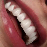 دستیار دندانپزشک خانم