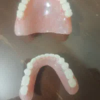 ساخت انواع دندان مصنوعی