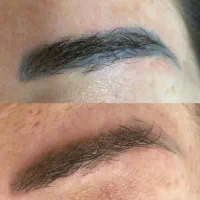 پاک کردن تتو.لیزرکیوسوییچ.PRP.کربن تراپی.روشن سازی|خدمات آرایشگری و زیبایی|اصفهان, سعادتآباد|دیوار