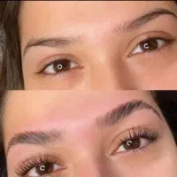 لیفت ابرو کاشت مژه رایگان