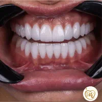شرایط اقساطی خدمات دندانپزشکی ایمپلنت،ارتودنسی،|خدمات آرایشگری و زیبایی|جلفا, |دیوار