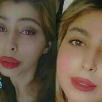 پکیج فوری ۳۰ روزه چاقی صورت