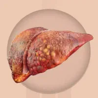 پکبچ بهبود دیابت|آرایشی، بهداشتی، درمانی|بندرعباس, |دیوار