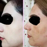 کرم معجزه سفید کننده اصل تایلند