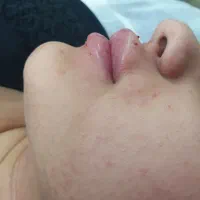 بوتاکس و ژل|خدمات آرایشگری و زیبایی|تهران, مطهری|دیوار