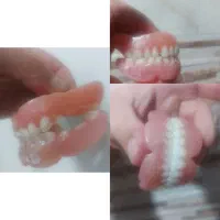 چی بود و چی شد دندان مصنوعی|فعالیت داوطلبانه|ایجرود, |دیوار