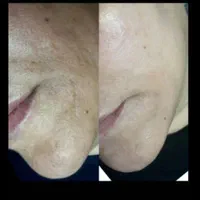 کرم معجزه شب زیرنظرپزشک کاملاگیاهی|آرایشی، بهداشتی، درمانی|ساوه, |دیوار