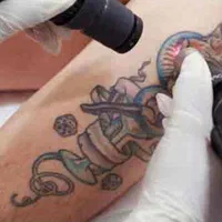 تزریق چربی ژل بوتاکس ساکشن غبغب درمان زگیل میخچه|خدمات آرایشگری و زیبایی|یاسوج, |دیوار