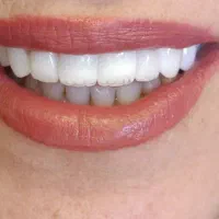 دندانپزشکی بیمه تامین اجتماعی کمیته امدادوبهزیستی|خدمات آرایشگری و زیبایی|نورآباد, |دیوار