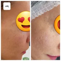 فشیال و خدمات جوانسازی ارغوان فقط دویست هزار تومان|خدمات آرایشگری و زیبایی|نیشابور, دارایی|دیوار