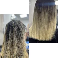 تخفیف ویژه لاین پروکراتین
