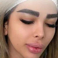 مزو تراپی پی آر پی پوست و مو کاشت مو و ابرو