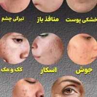 دمنوش های صد درصد طبیعی و روغن های معجزه گر