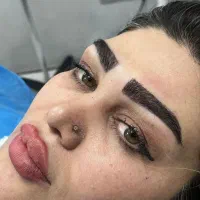 کاشت مو فقط در یک روز با ضمانت تراکم|خدمات آرایشگری و زیبایی|اصفهان, کشاورزی|دیوار