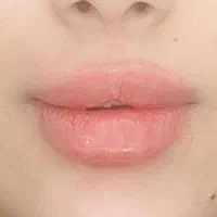 تزریق ژل و بوتاکس، لیزر موهای زائد، لاغری تضمینی|خدمات آرایشگری و زیبایی|رشت, دیلمان|دیوار