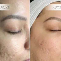 فیشیال پوست ارزون