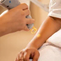 لیزر موهای زائد با جدید ترین دستگاه کندلا در چیتگر|خدمات آرایشگری و زیبایی|تهران, گلستان (شهرک راه آهن)|دیوار