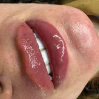 تزریق و آموزش ژل و بوتاکس|خدمات آرایشگری و زیبایی|تهران, مسعودیه|دیوار