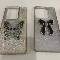 قاب گوشی|لوازم جانبی موبایل و تبلت|اهواز, کوی مهدیس|دیوار