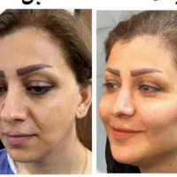 خدمات زیبایی ارزان